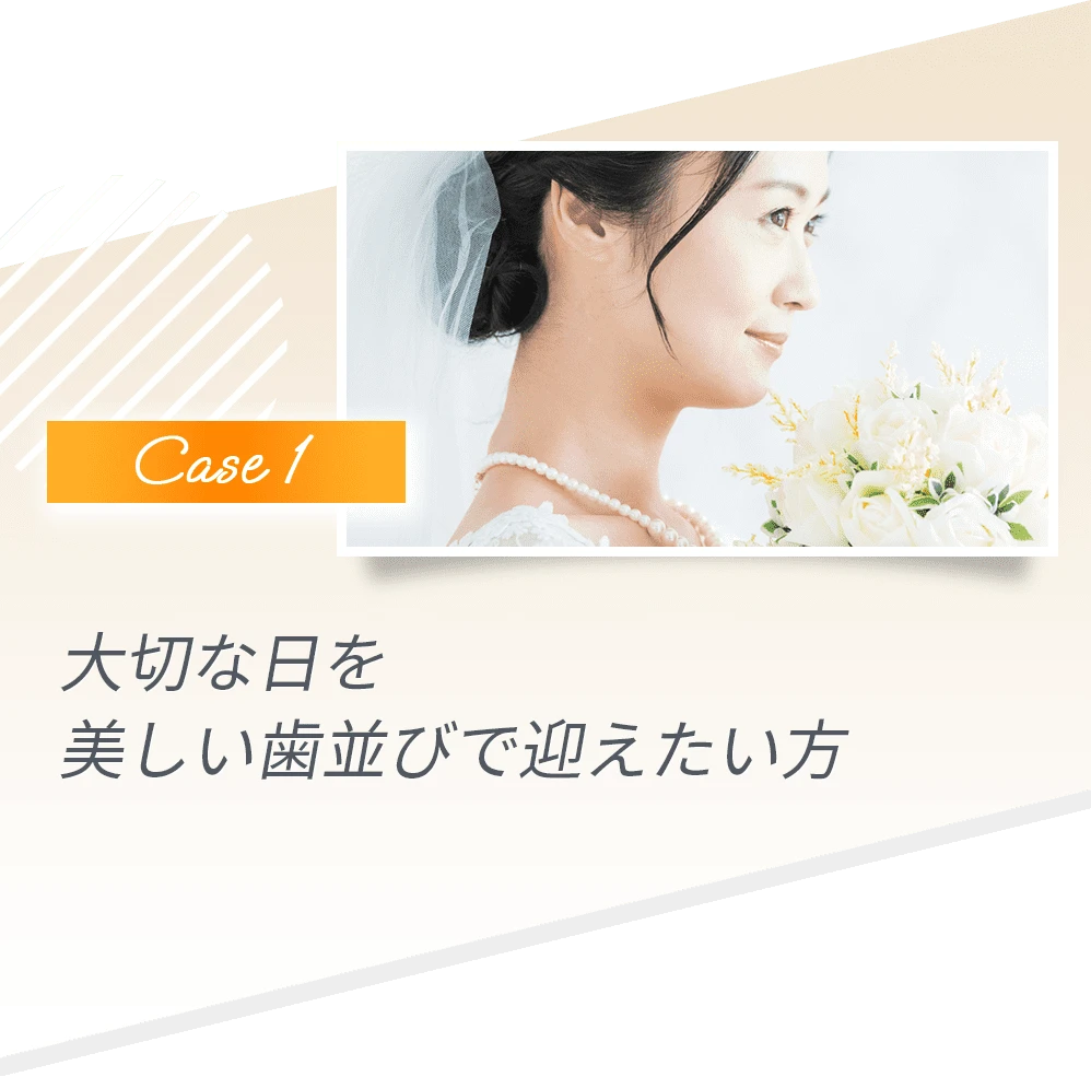 結婚式を迎える女性