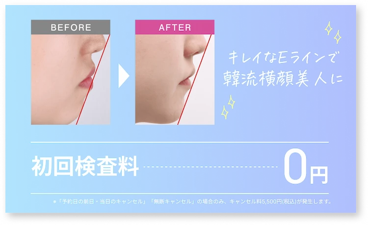 初回検査料0円 キレイなEラインで韓流横顔美人に