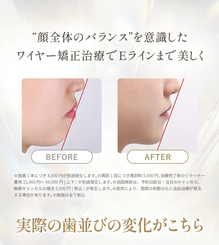 “顔全体のバランス”を意識したワイヤー矯正治療でEラインまで美しく